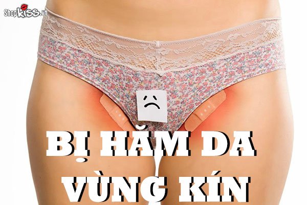 Bị hăm da vùng kín ở người lớn có nguy hiểm không?