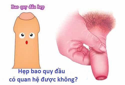 Hẹp bao quy đầu có quan hệ được không?