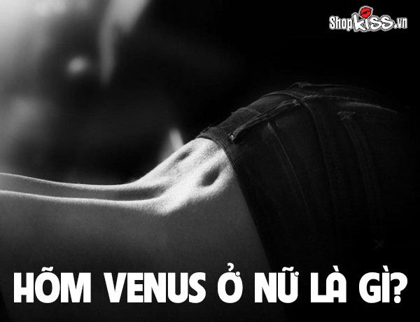 Hõm Venus ở nữ là gì? Ý nghĩa của hõm Venus