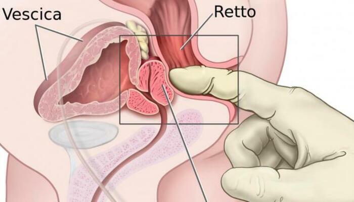 Kích thích tuyến tiền liệt nam giới sao cho sướng nhất