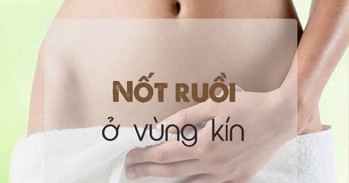 Nốt ruồi ở vùng kín nữ là xấu hay tốt? Có nghĩa gì?