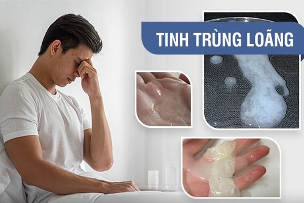 Tinh trùng loãng là gì & nguyên nhân khiến trinh trùng loãng