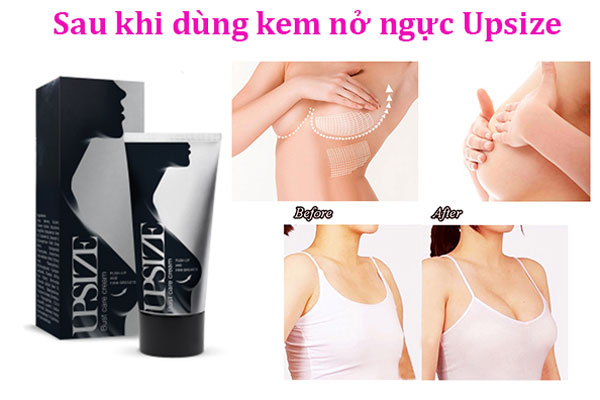 Kem nở ngực Upsize có tốt không, mua ở đâu, giá bao nhiêu